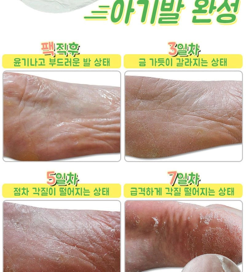 Elizavecca - Witch Piggy Hell Pore Turtle's Foot Pack [40g x 1pair]