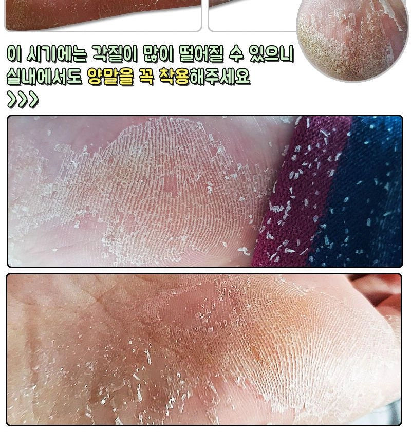Elizavecca - Witch Piggy Hell Pore Turtle's Foot Pack [40g x 1pair]