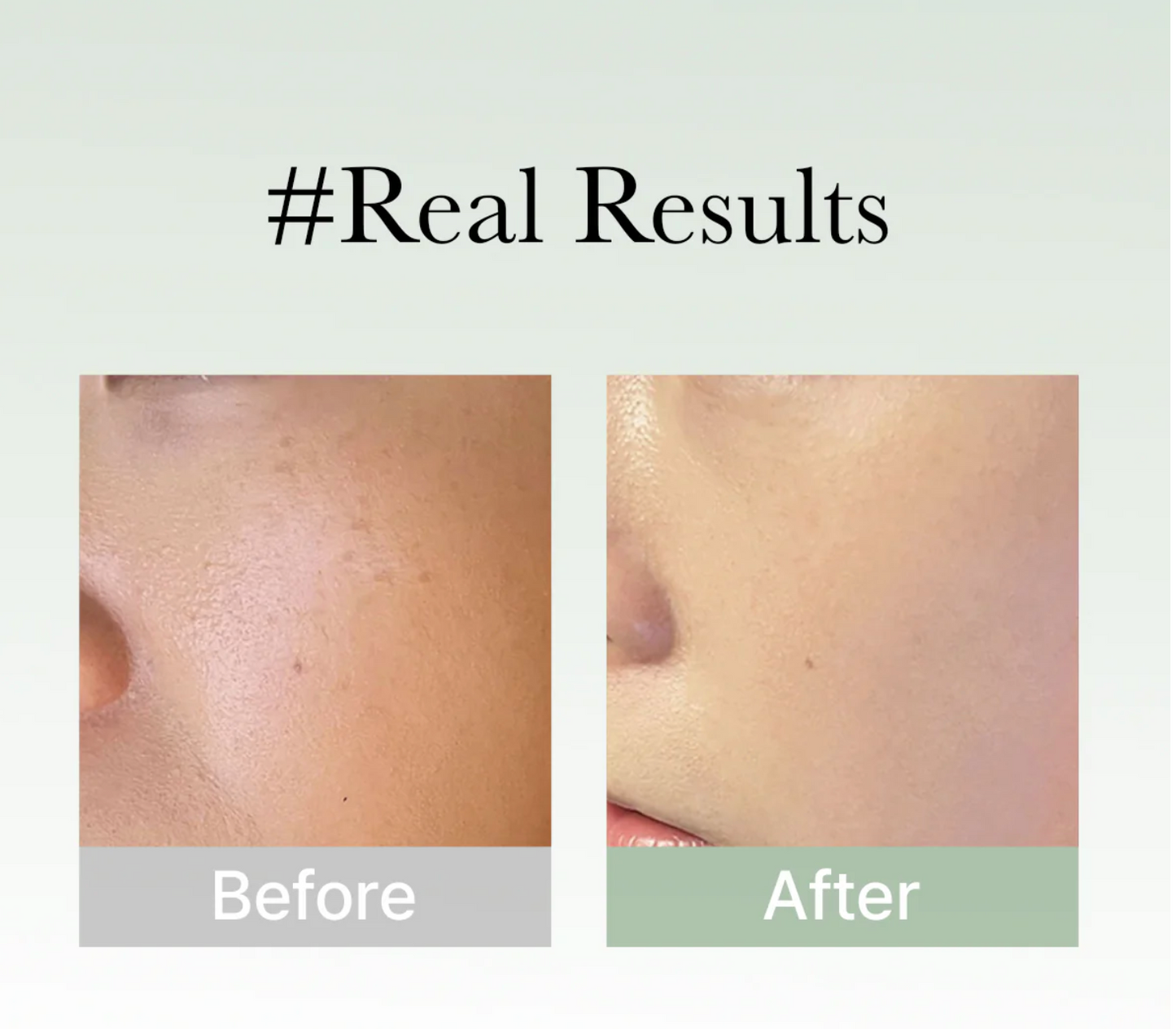 Arencia holy hyssop serum