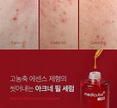 Medicube-Red Acne Succinic Acid Peel